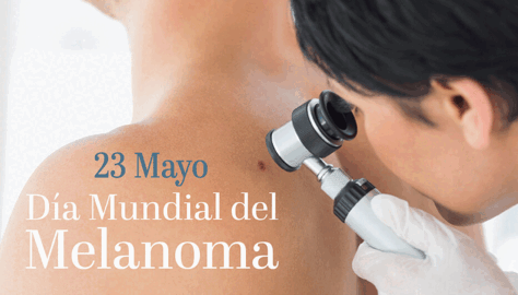 Día Mundial contra el Melanoma