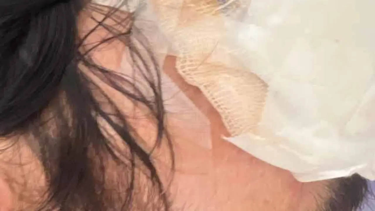 Alberto, afectado por una agresión homófoba