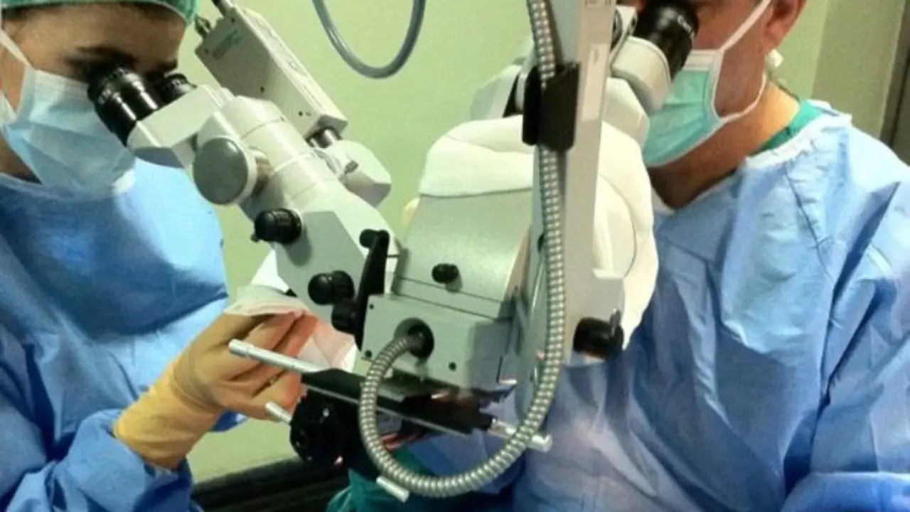 Transplante de córnea.