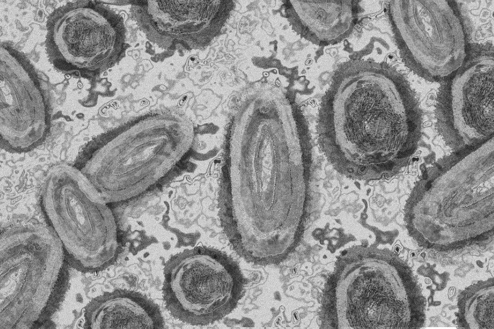 virus mono 1